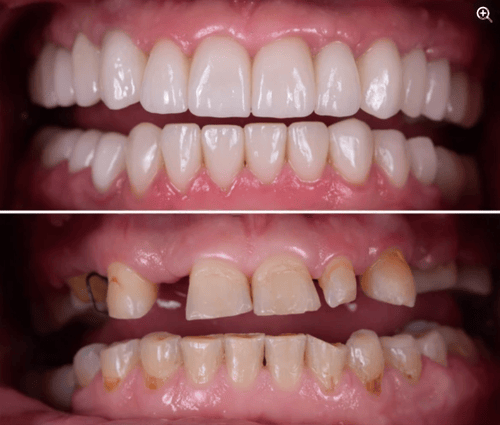 Captura_de_pantalla_2024-03-19_125233-transformed