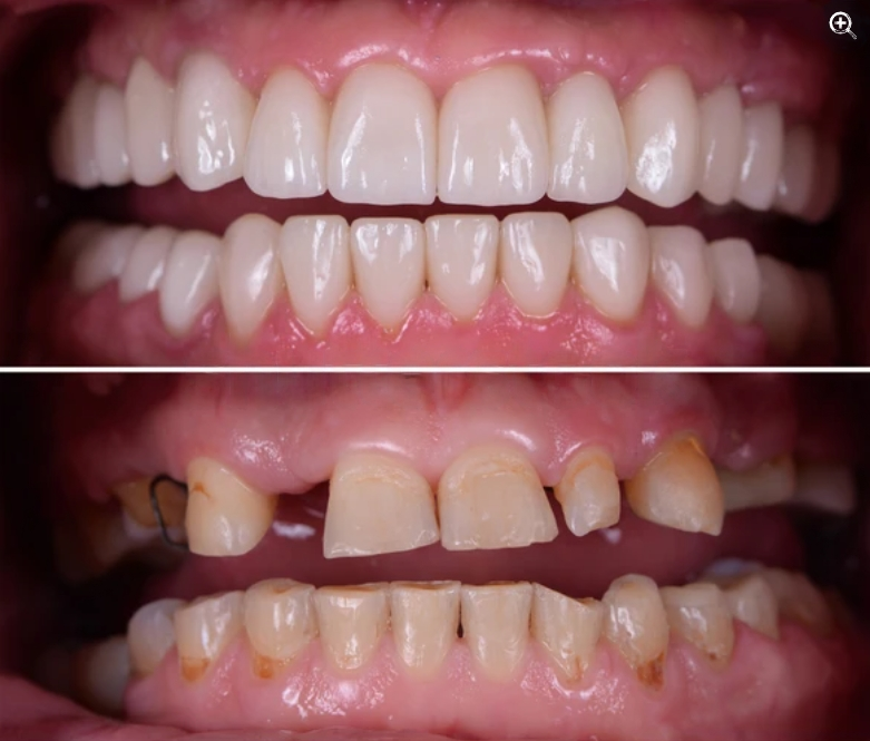 Captura_de_pantalla_2024-03-19_125233-transformed